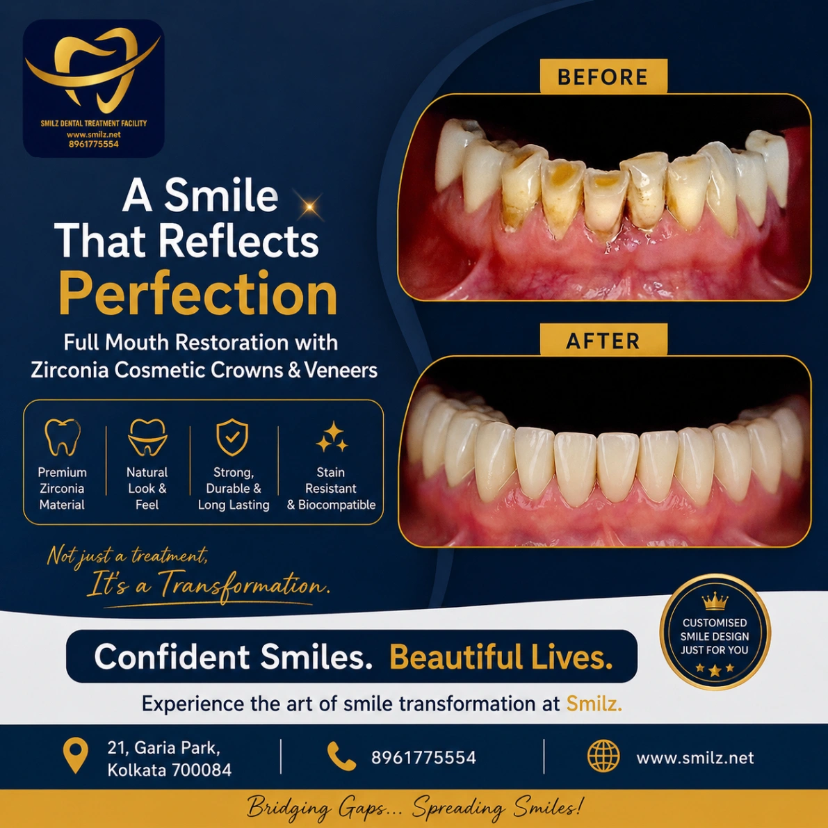 Smilz Dental Garia Full Mouth Rehabilitation