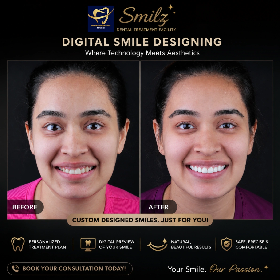 Digital Smile Designing in Kolkata