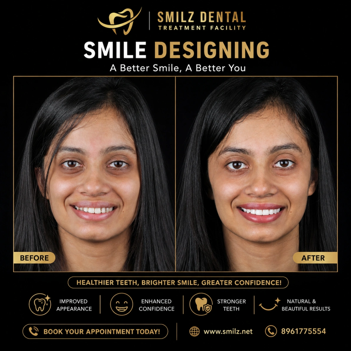 Smile Designing in Kolkata