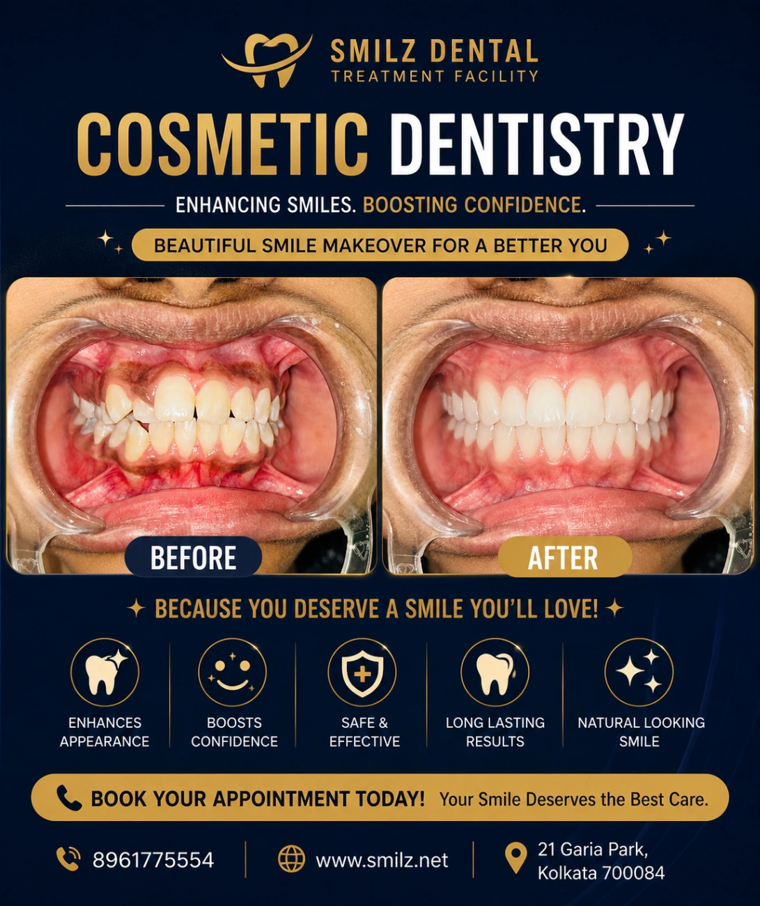 Cosmetic Dentistry in Garia, Kolkata | Smilz Dental Treatment Facility