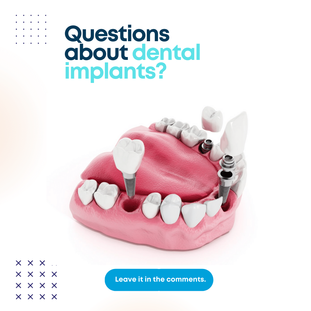 Dental Implants vs. Bridges: Which Is Right for You?