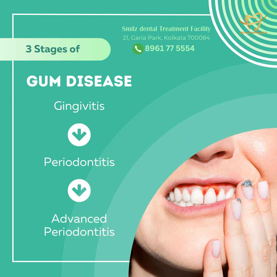 Unveiling the Mystery: Why Your Gums are Bleeding