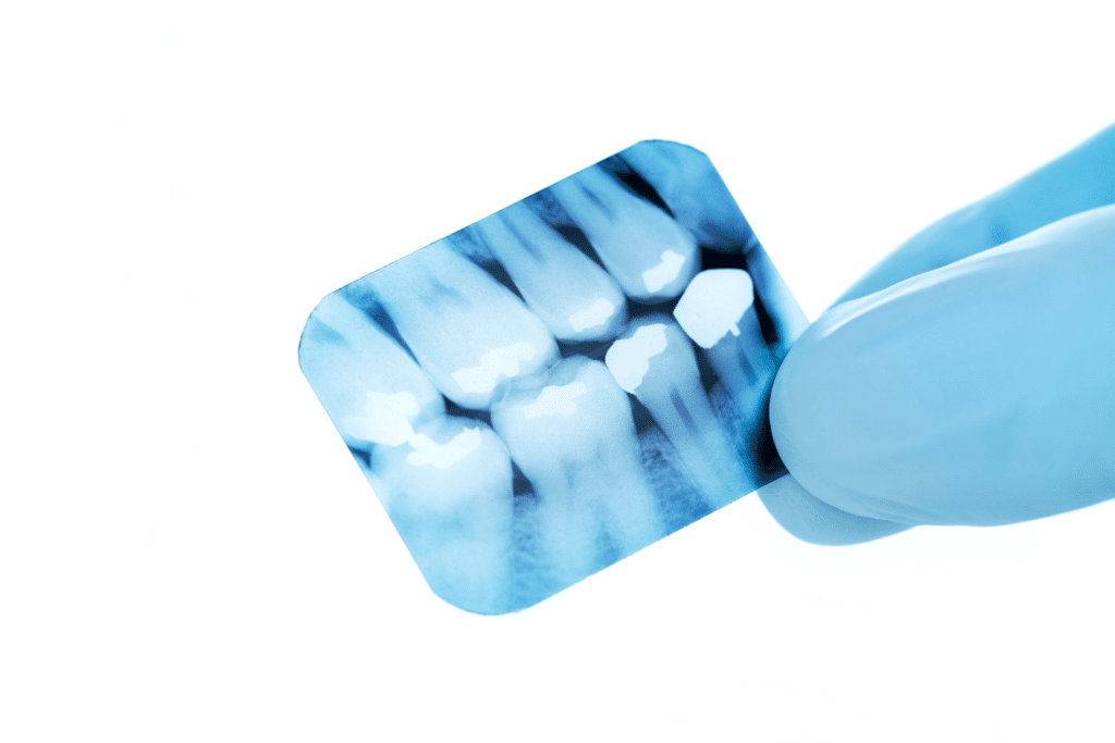 Painless Root Canal Treatment in Garia | Save Your Tooth at Smilz Dental