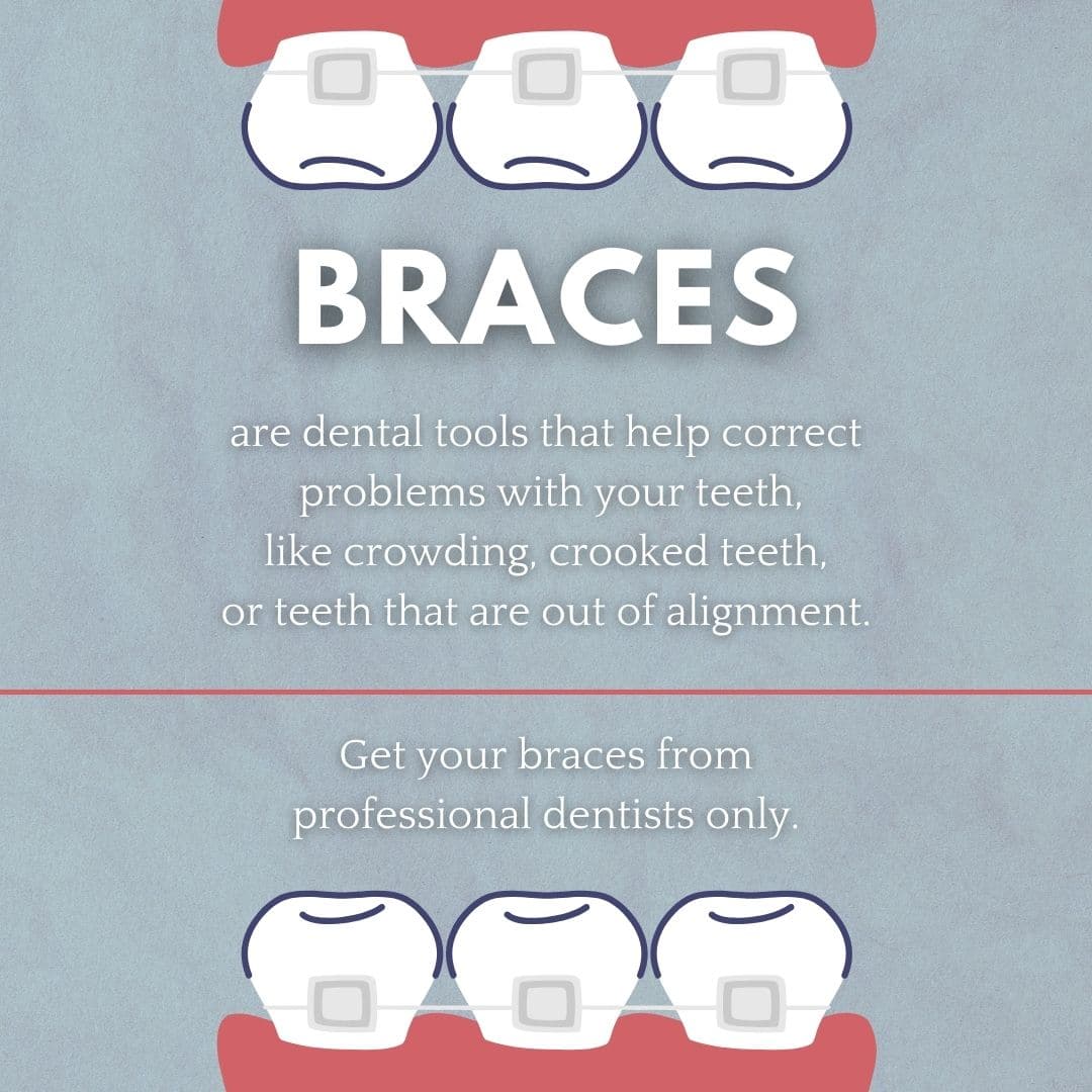 Orthodontic Braces